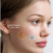 Patch de boutons colorés